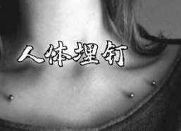 年下锁骨钉,创新医疗技术，重塑骨骼健康新篇章